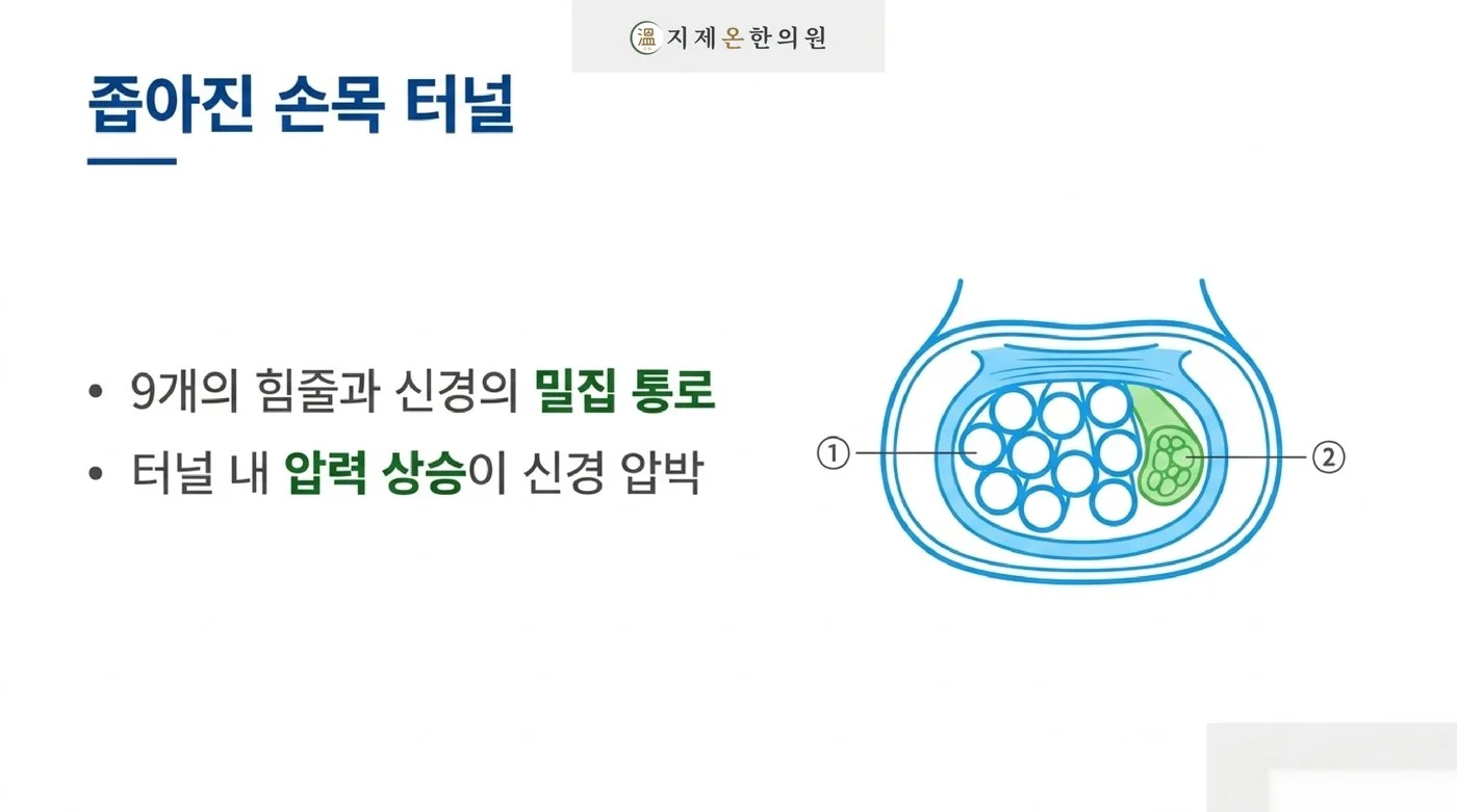 아홉 개의 힘줄과 정중신경이 함께 지나는 좁은 손목 터널과 압력이 올라가며 눌리는 신경