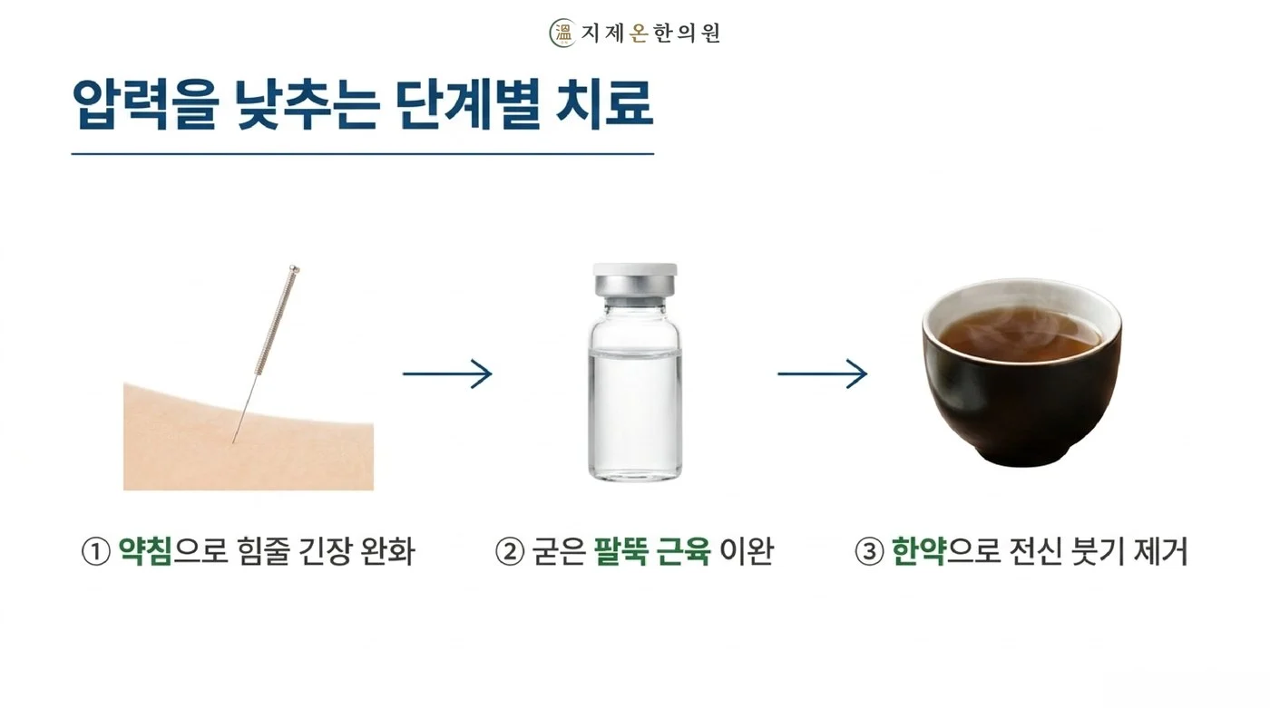 약침으로 힘줄 긴장을 풀고 굳은 팔뚝 근육을 이완하며 한약으로 전신 붓기를 다스리는 단계별 치료