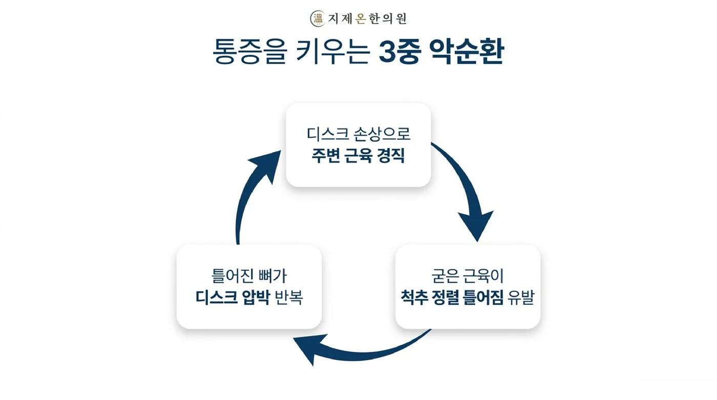 디스크 손상, 굳은 근육, 틀어진 척추 정렬이 서로 통증을 키우는 허리디스크 악순환
