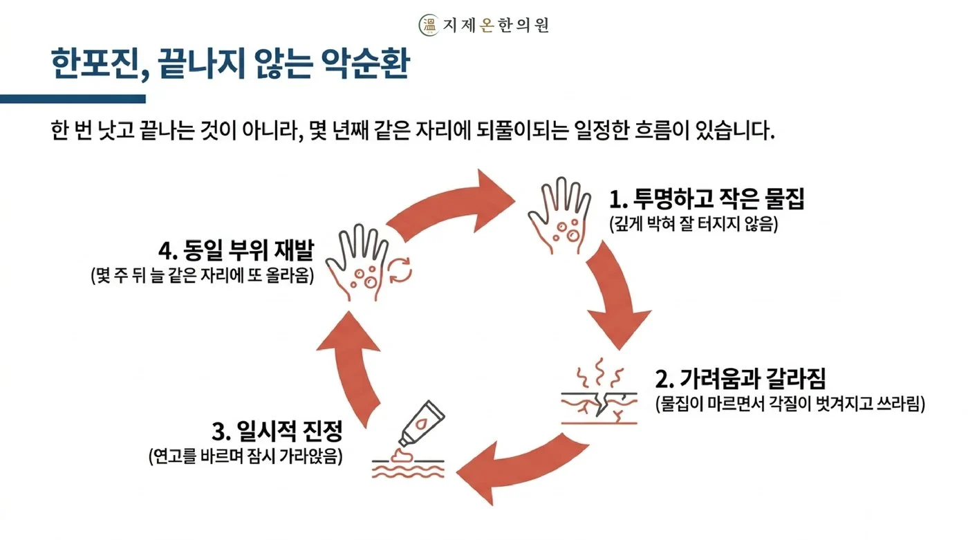 투명하고 작은 물집, 가려움과 갈라짐, 연고로 일시적 진정, 같은 부위 재발로 이어지는 한포진의 반복되는 흐름