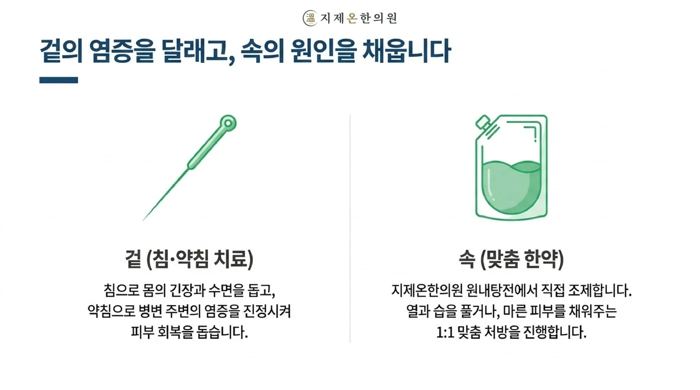 침과 약침으로 겉의 염증과 긴장을 달래고 원내탕전 맞춤 한약으로 속의 조건을 다스리는 치료