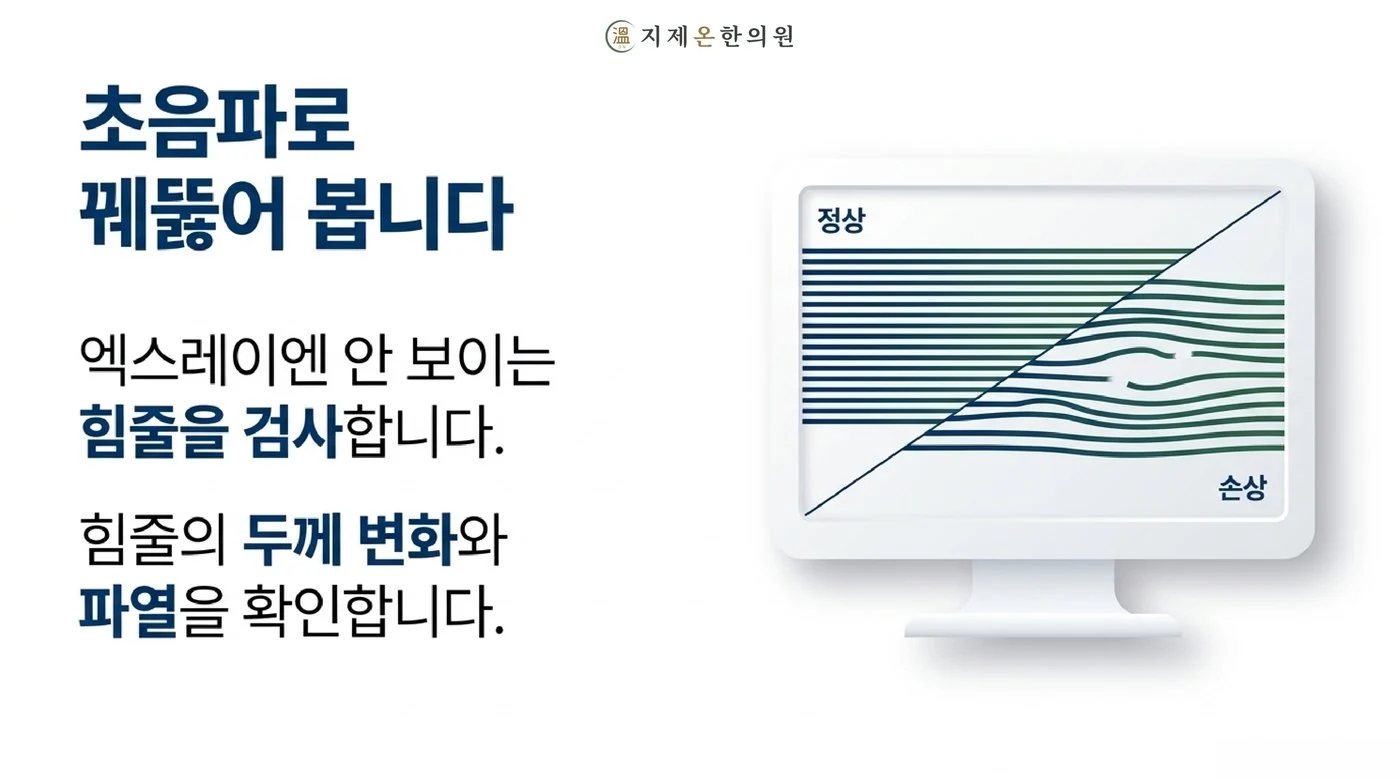 엑스레이에 보이지 않는 힘줄의 두께 변화와 파열을 초음파로 정상과 비교해 확인하는 검사