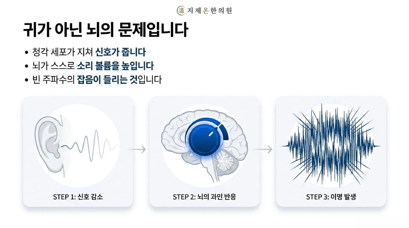 청각 세포가 지쳐 신호가 줄면 뇌가 스스로 소리 볼륨을 높여 빈 주파수의 잡음이 들리게 되는 이명의 단계