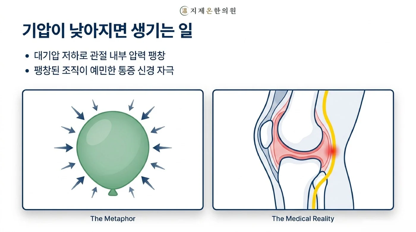대기압이 낮아지면 풍선이 부풀듯 관절 내부 압력이 팽창해 예민한 통증 신경을 자극하는 원리