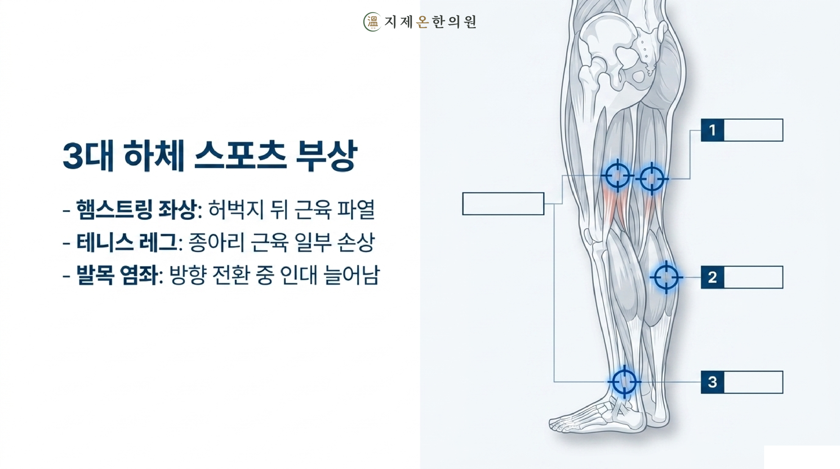 3대 하체 스포츠 부상